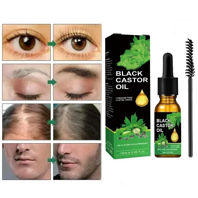 Organic Black Castor Oil for Hair Growth Strengthening Scalp Dense Anti Baldness Hair Loss Prevention Repair Nourishing Liquid