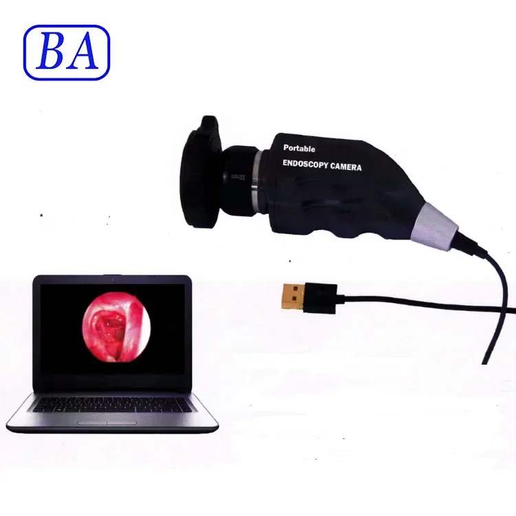 Medical Surgical Portable Endoscope Camera Usb