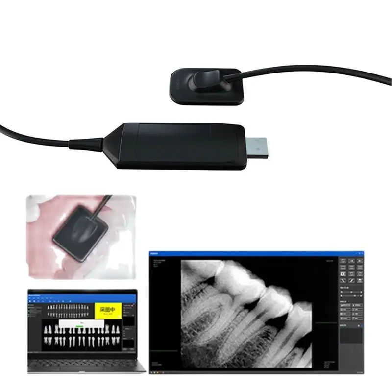 Sensor odontológico de raio X dental, sistema intra-oral digital, imagem H e D, alta frequência, R