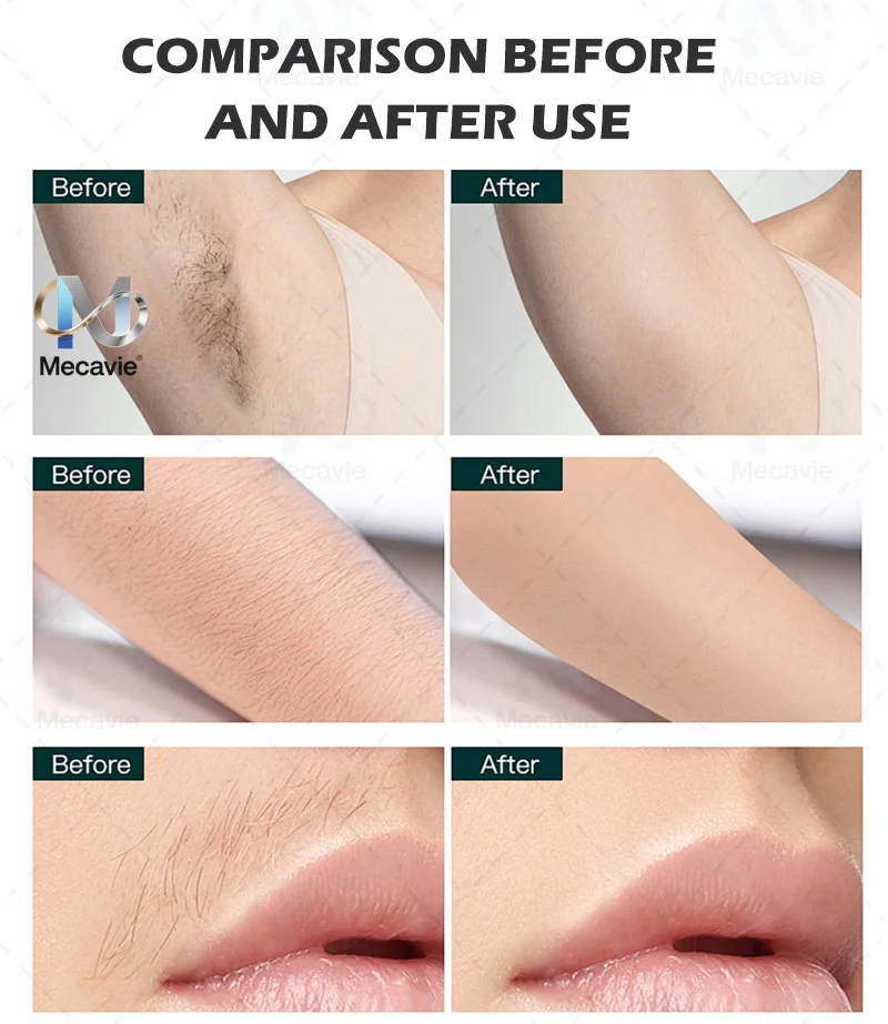 2026 ليزر بيكو ثانية جديدة من FAC Tech 4000 وات، تقنية الصمام الثنائي ذات 4 أطوال موجية، إزالة شعر وشم دائمة سريعة غير مؤلمة، ممتازة #6