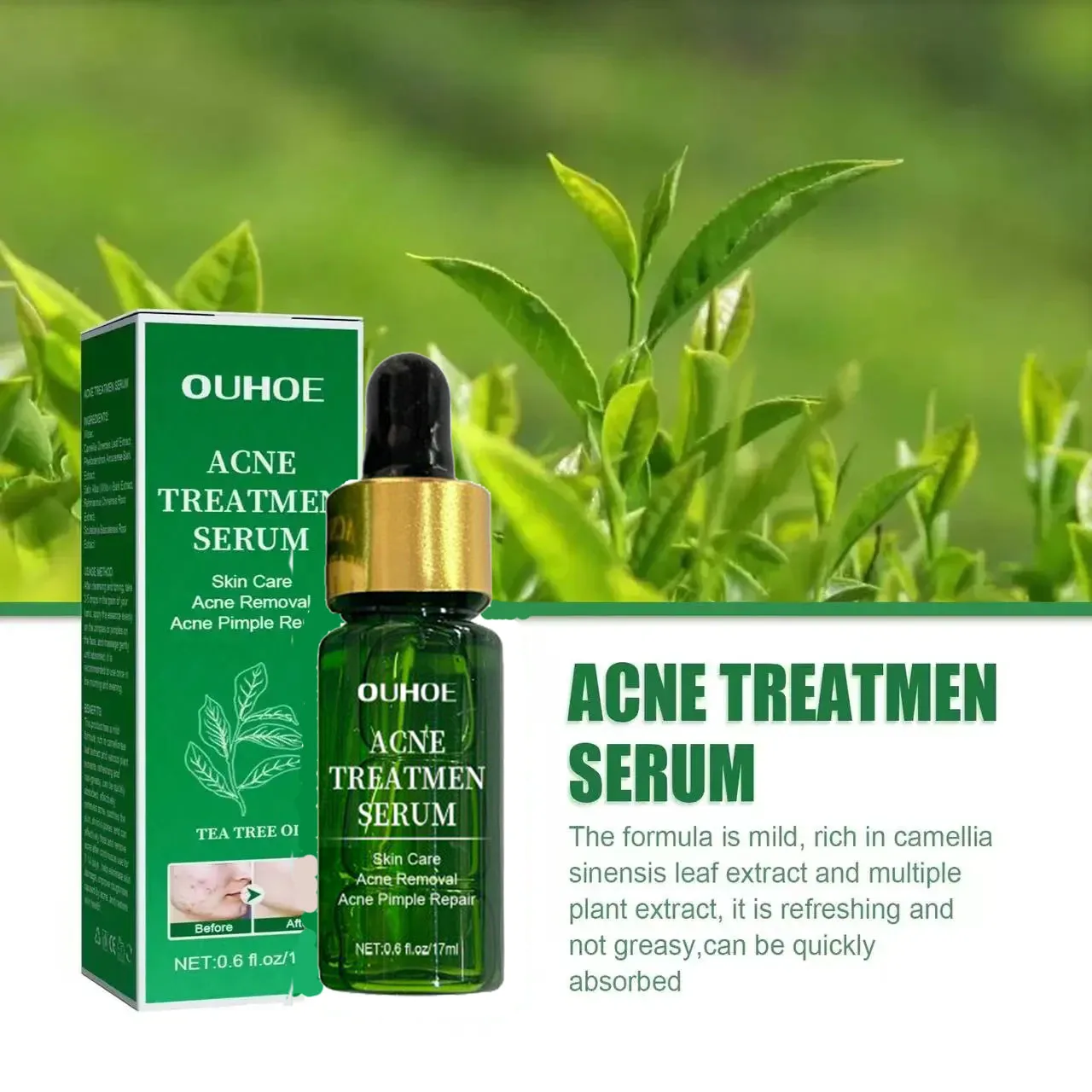 Acne Behandeling Gezicht Serum Porie Krimpende Huidverzorging Tegen Gezicht Acne Puistje Vlekken Verwijderaar Cleaning Krimpt Poriën Tea Tree Serum