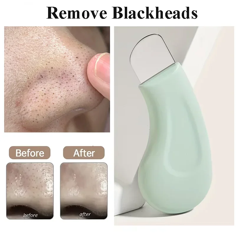 Deep Cleansing Master Blackhead Removal Tool Compatible with Mud Cream and Cleansing Oil for Pore Cleansing Facial Beauty Tool