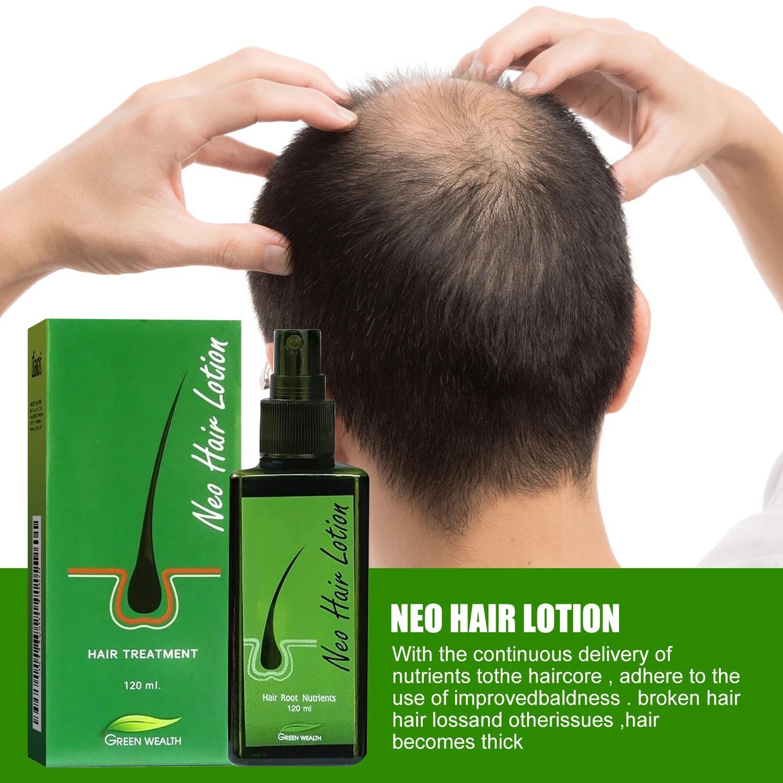 Hair Treatment Spray Anti Hair Loss Prevent Baldness Scalp Treatment Repair Roots Nourish Scalp Revitalize Hair Root Care