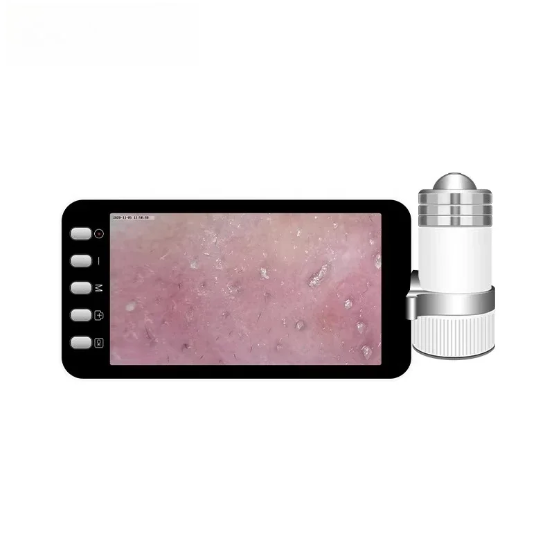 Meiboyi البسيطة التحقيق العروة رئيس محلل فروة الرأس معدات صالون تجميل الماسح الضوئي المحمولة آلة تحليل الشعر الشحن السريع #2