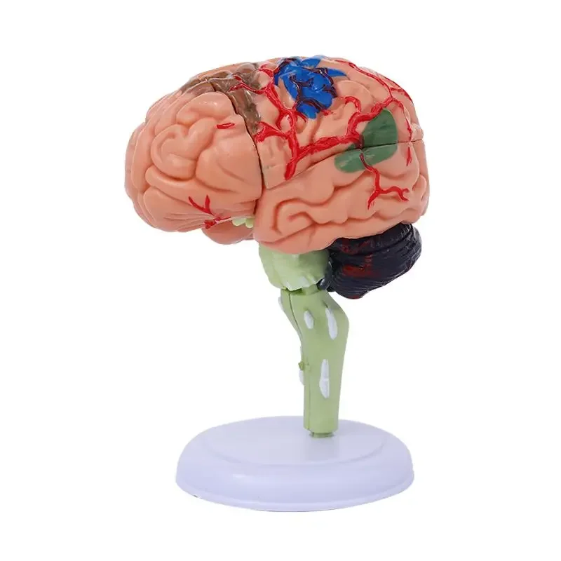 

Simulated Human Brain Model, 4D Brain Anatomy, Medicine Teaching, Detachable 31 Components