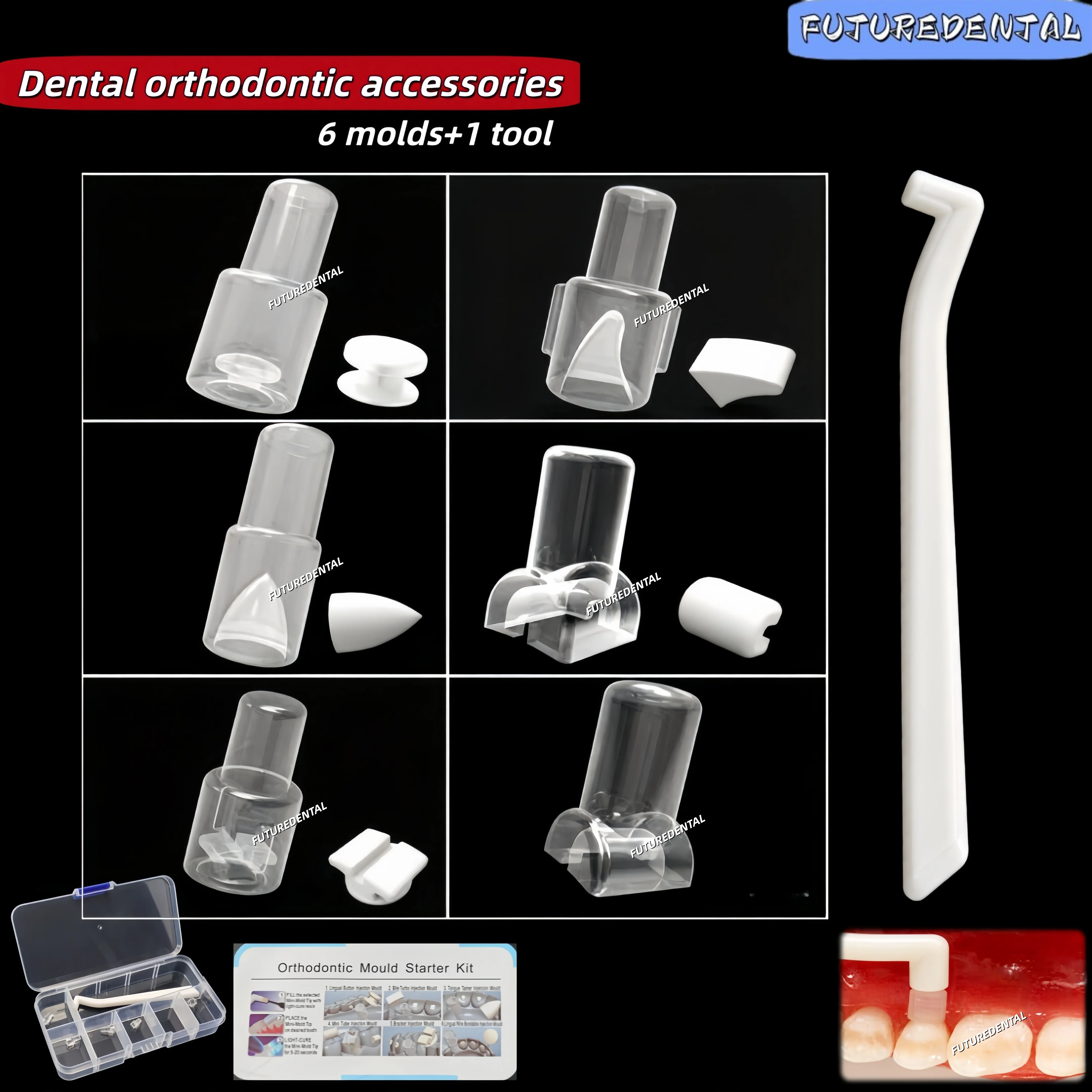 Dental Orthodontic Mould Starter Kit Flat Guide Template Invisible Correction Attachment Tongue Side Buckle Mold Bite Turbo
