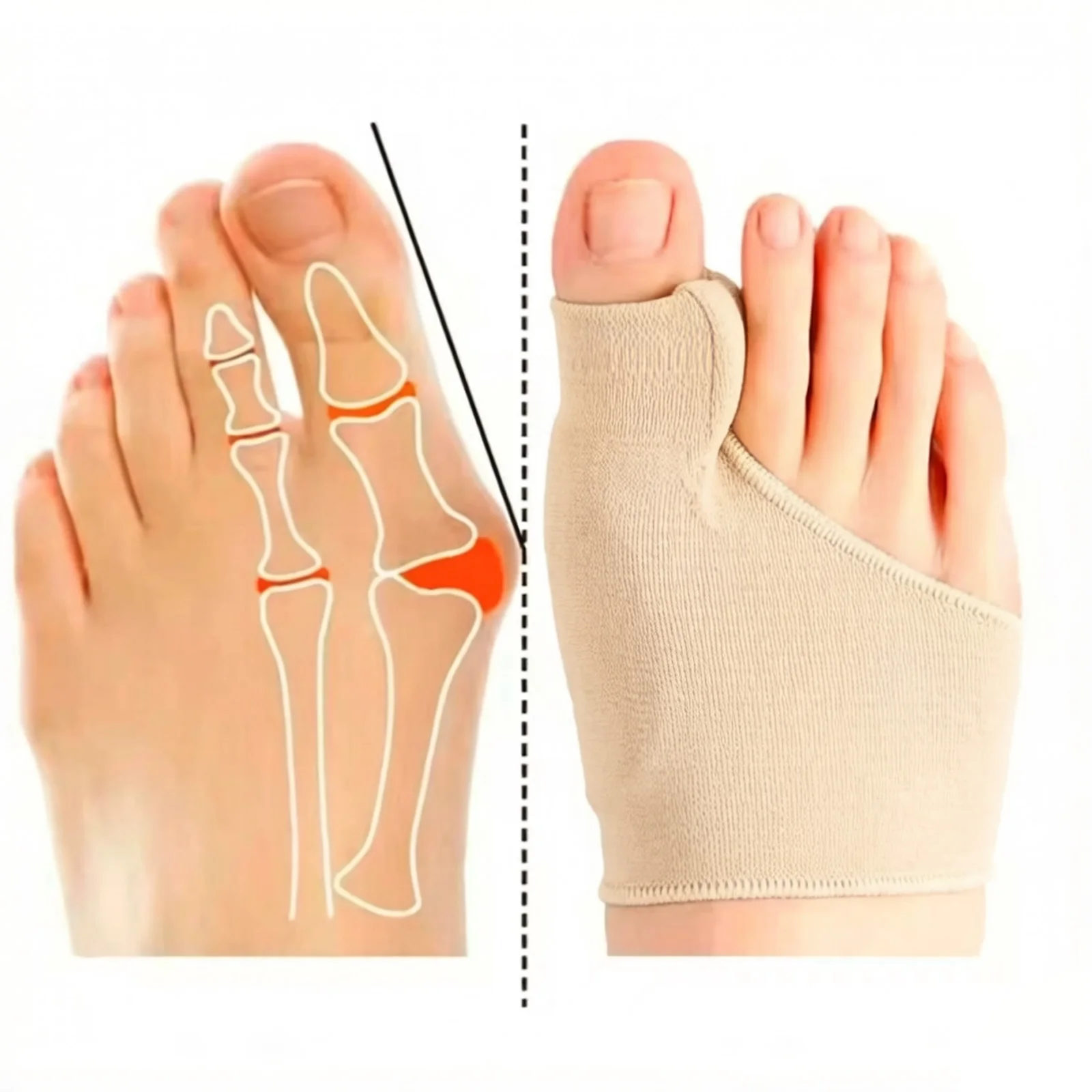 Toe Separator Bunion Corrector Hallux Valgus Orthotics Big Toe Straightener Splint Correction Pedicure Foot Care Women Men