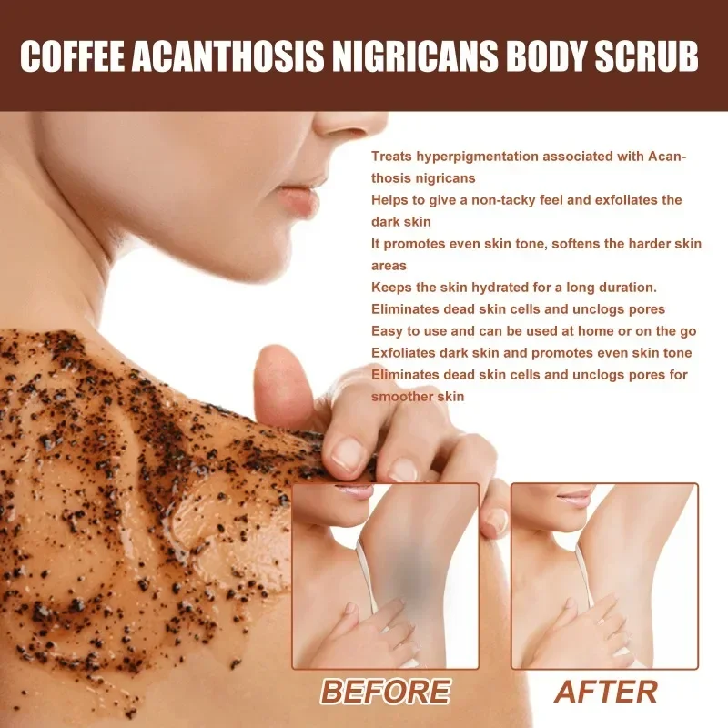 

Sdottor New Acanthus nigricans Body Scrub Armpit Knee joints brighten Bleaching Inner Thigh skin clean peeling exfoliating beaut