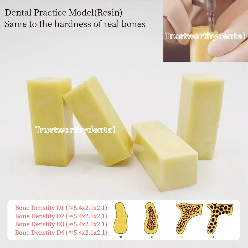 Dental Artificial Bone Models Bone Blocks D1–D4 Bone Densities D1/2/3/4 Jaw Bone Replica Implant Practice Resin Model