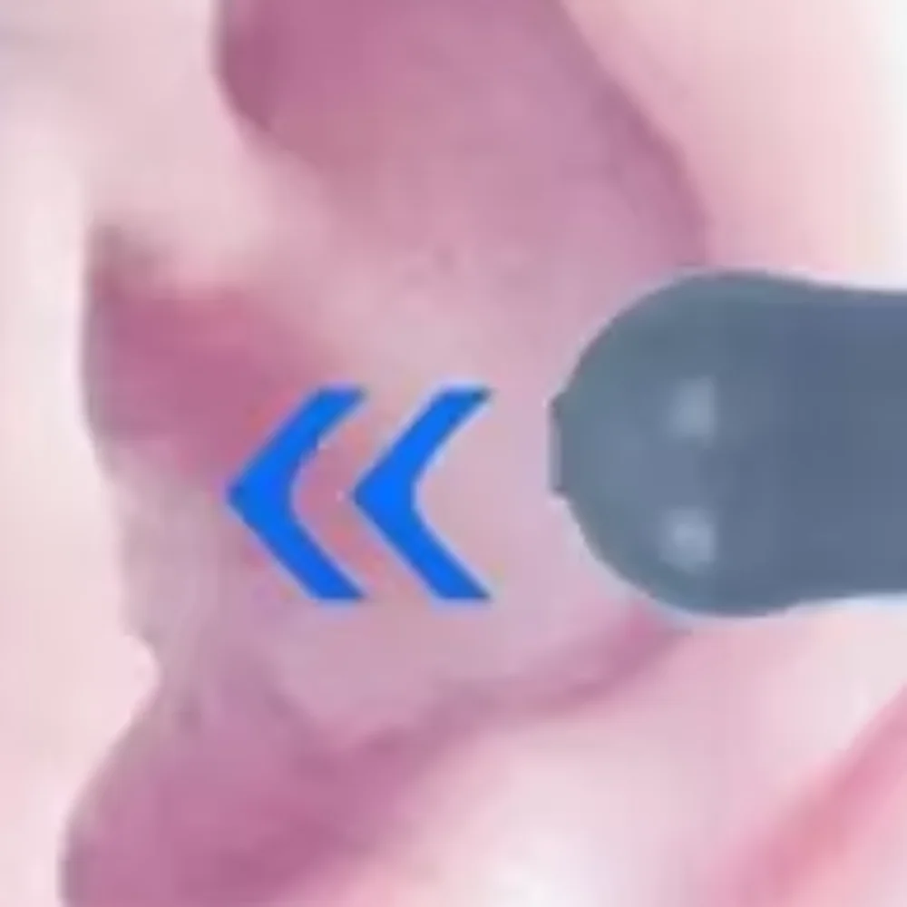 

Reusable Pressure Equalization Ear Plugs Soundproof Anti-Tinnitus Flight Ear Plugs Multifunction Noise Reduction Earbuds Travel