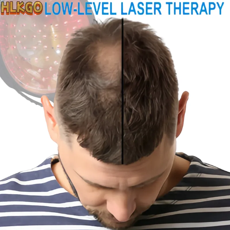 

Best 650nm Red Light Laser Hair Growth Hat Rechargeable LLLT Cap For Thinning Hair Treatment And Revitalizing
