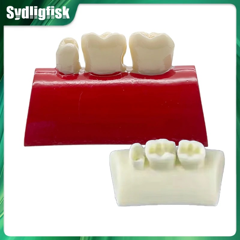 

1Pc Dental Inlay Exercise Model Block Filling Exercise Typodont Resin Oral Filling Model Practice Model Dentistry Teaching Study