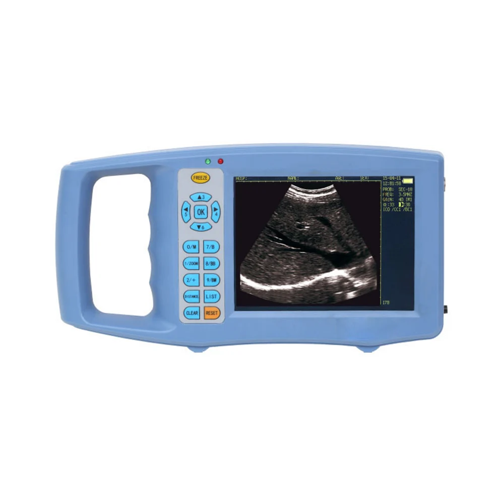 Factory price built-in lithium battery diagnostic portable veterinary ultrasound equipment