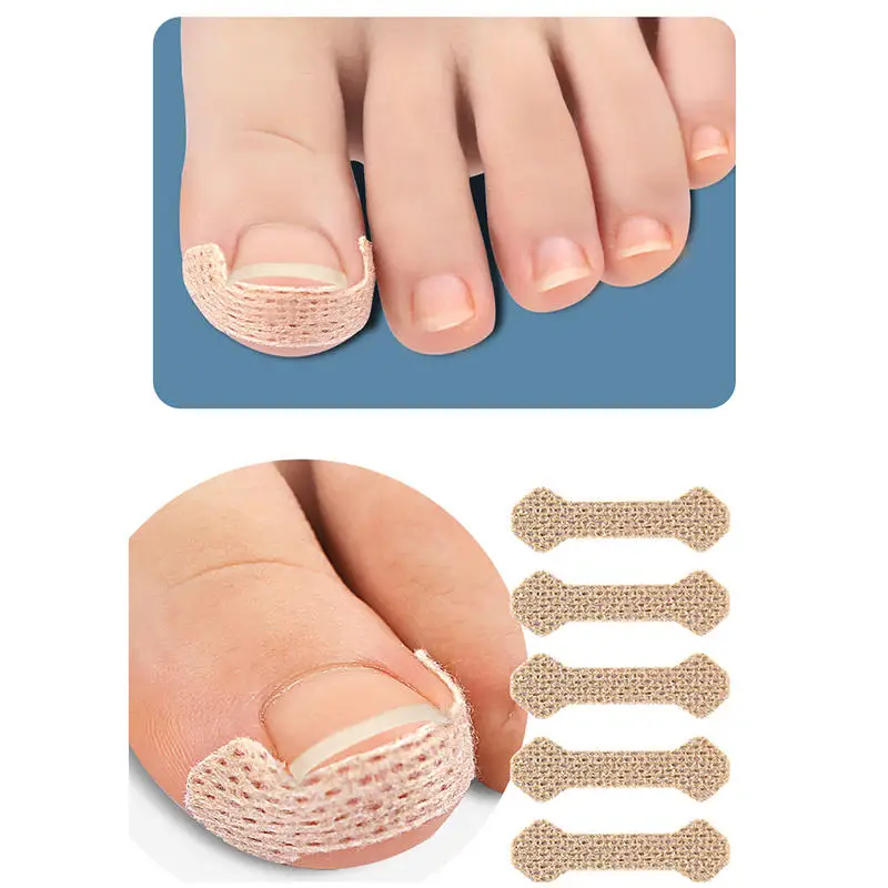 30/50/100pcs Nail Correctie Stickers Ingegroeide Teennagel Corrector Patches Behandeling Herstellen Pedicure Care Tool HOT KOOP