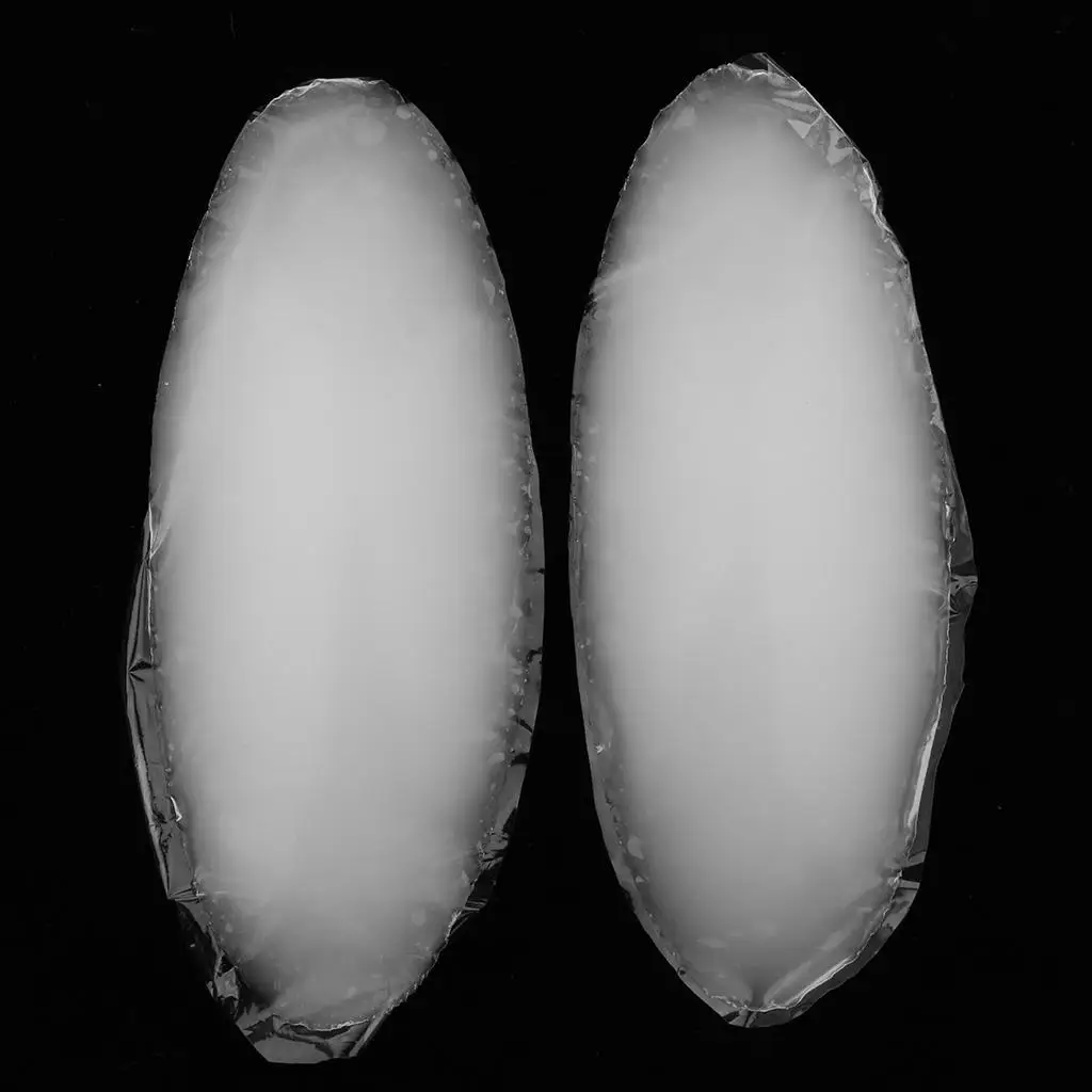 عبوتان من السيليكون ذاتية اللصق لتصحيح الساق على شكل ساق #2