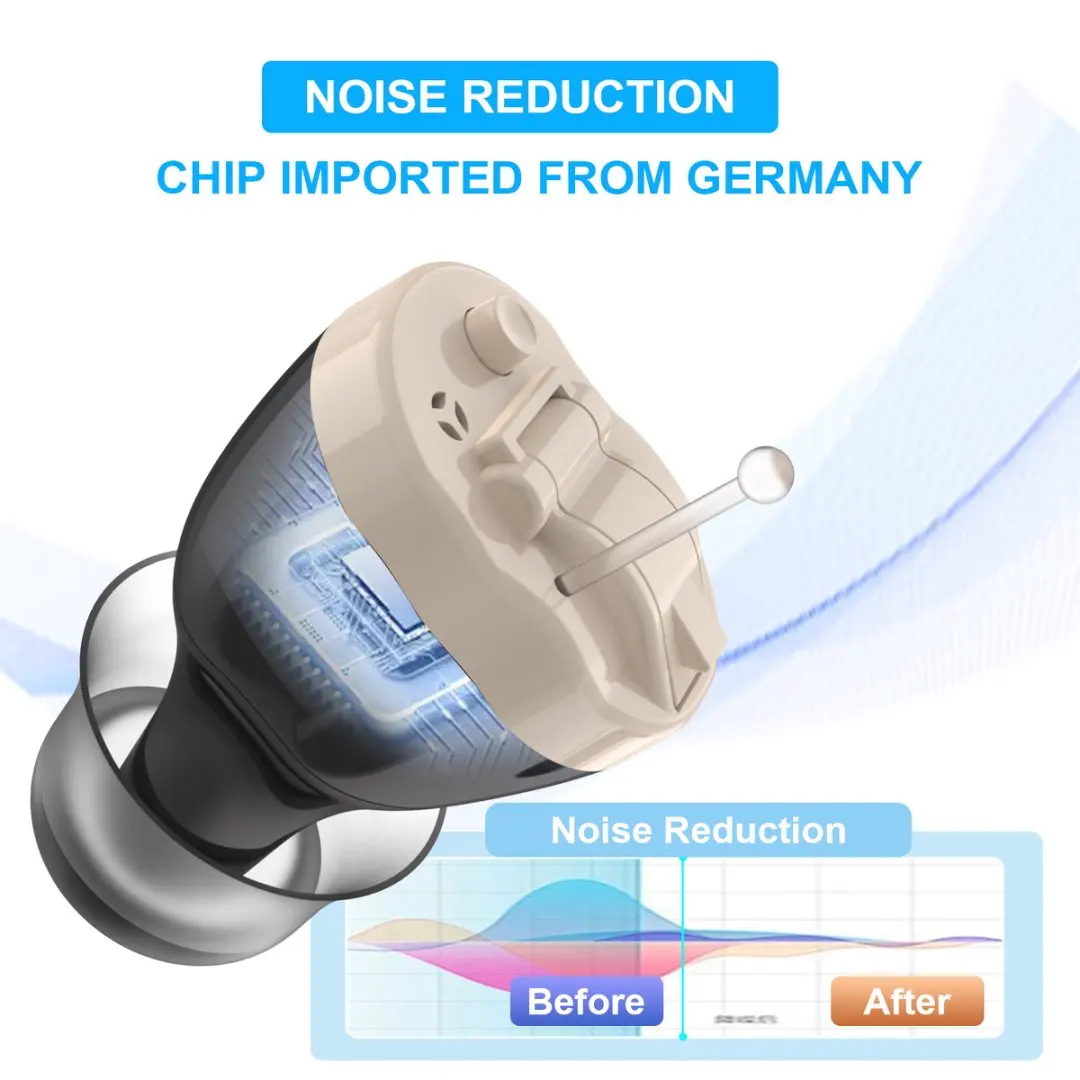 Feedback Cancellati…