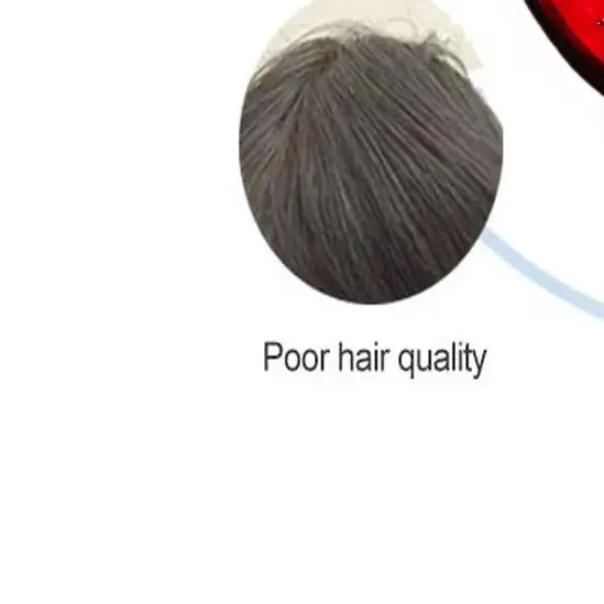 

LLLT Hair Growth Cap 96 Diodes Hair Loss Prevention And Repair Treatment For Thicker Fuller Hair Results