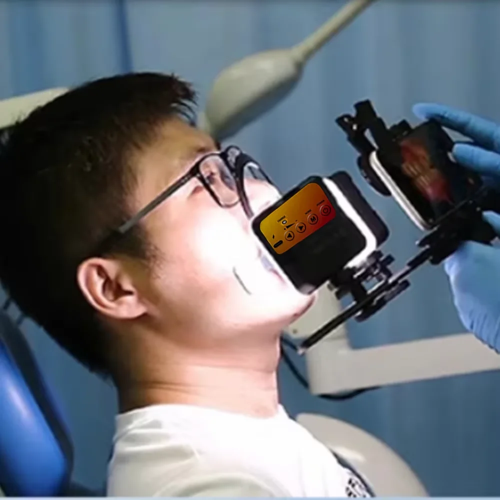 

Dental Photography Light - Adjustable Brightness Oral Filling Flash for Phone Camera Mounting & Clinical Procedures
