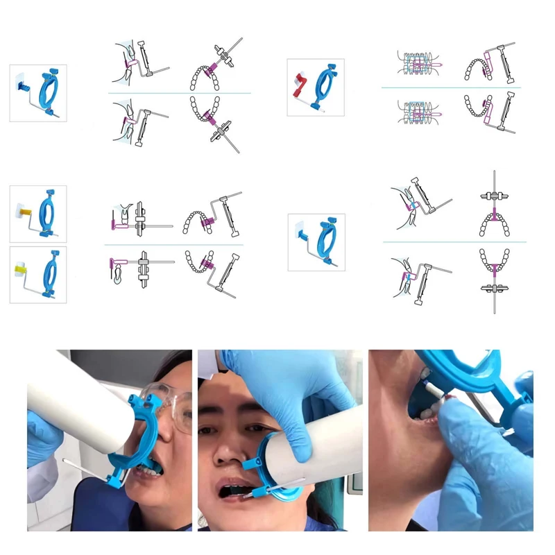 12Pcs Dental X-Ray Film Positioner Holder Film Positioning System Intra Oral Digital X-Ray Film Locator Dentistry Lab Equipment