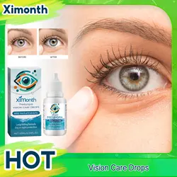 Eye Drops For Presbyopia Rehabilitation Relieve Visual Fatigue Treat Blurred Vision Improve Dry Itchy Eye Eyesight Improvement