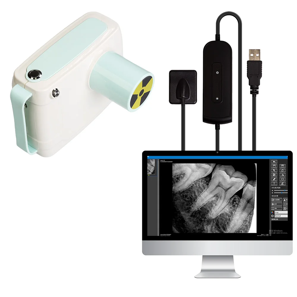 

Portable Digital X-Ray Machine for Human & Veterinary Medical with LED & Sensor