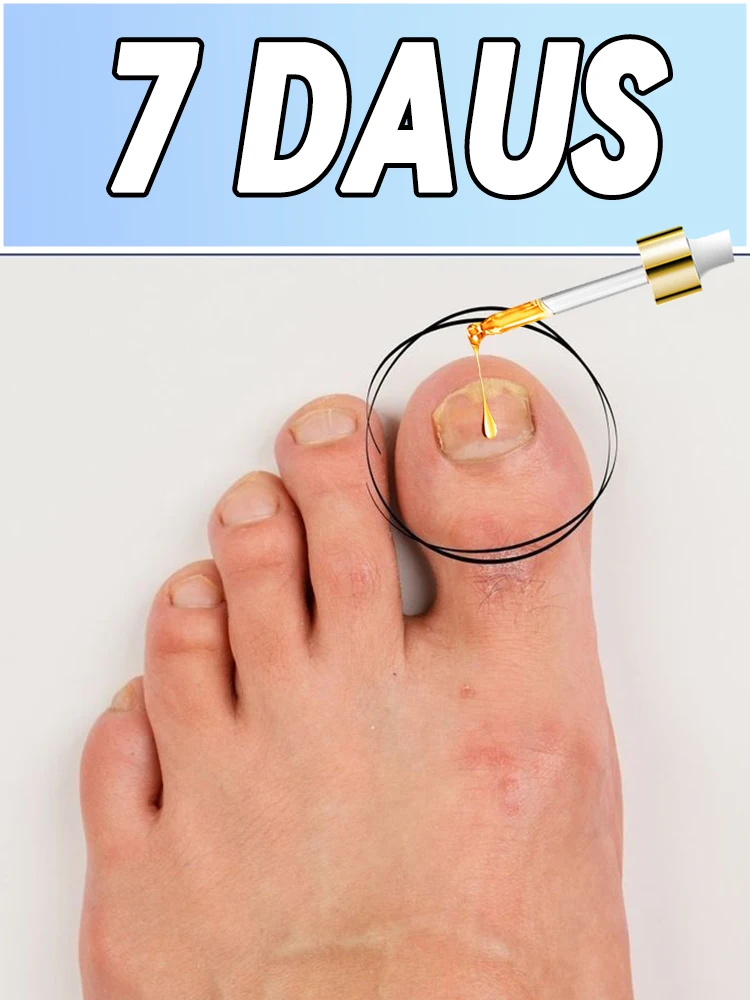 

Onychomycosis patch products are hot-selling and on sale, welcome to visit us!