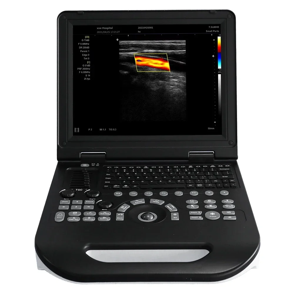 15 Inch HD Display Notebook Color Multi Language Portable Doppler Ultrasound Machine