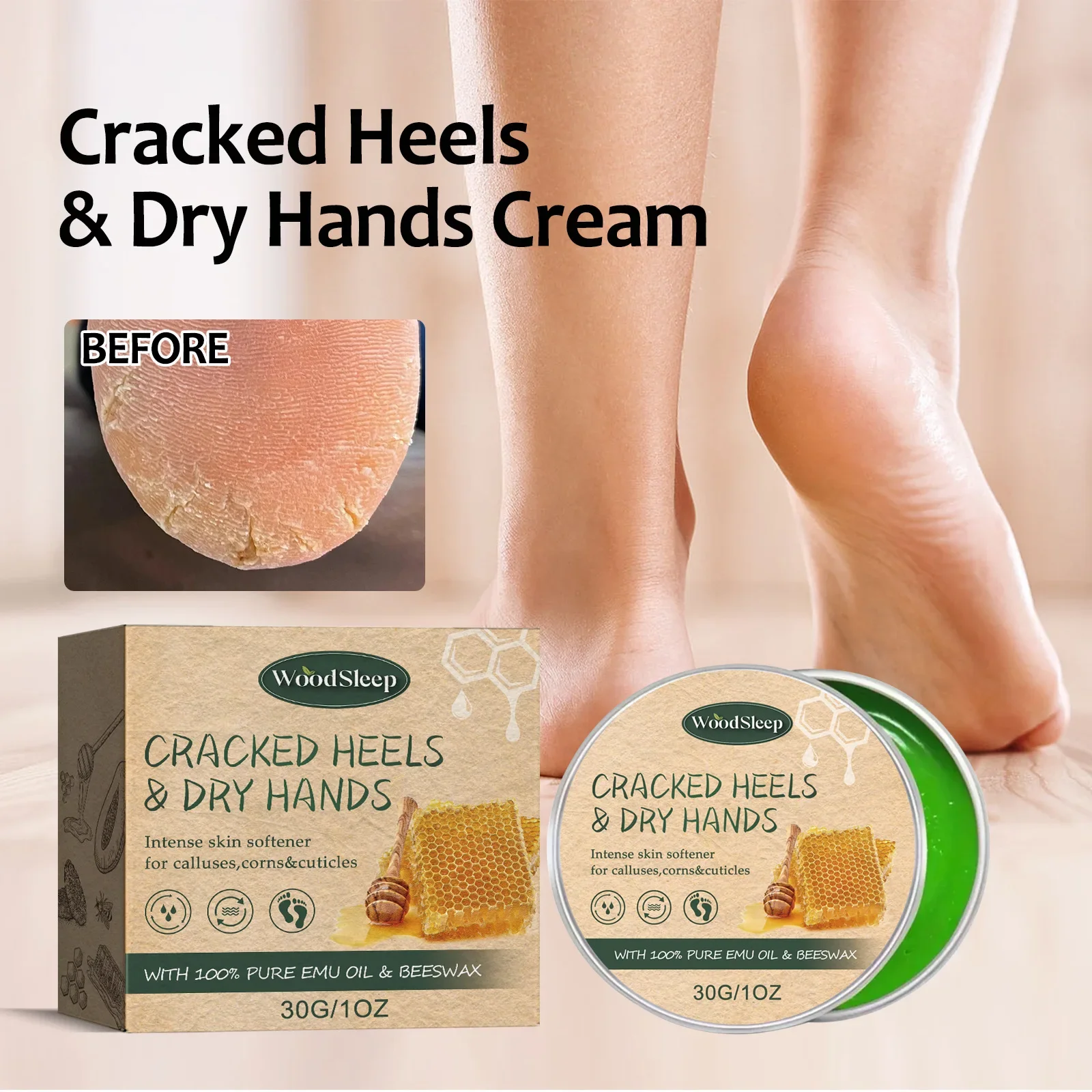 Woodsleep Hand and Foot Neck Cream Heel Anti-Chapping Recovery Cream Cracking Cracking Moisturizing and Nourishing Protection