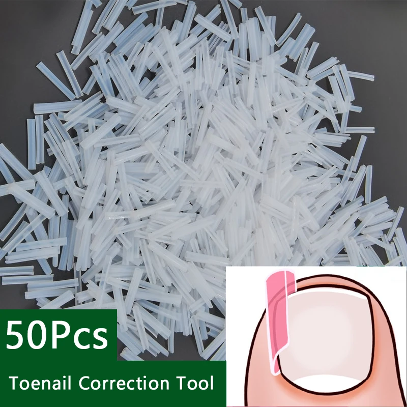 50Pcs/Box Ingrown Toenail Correction Strips Paronychia Correction Straightening Brace Toe Nail Treatment Groove Pedicure Tools