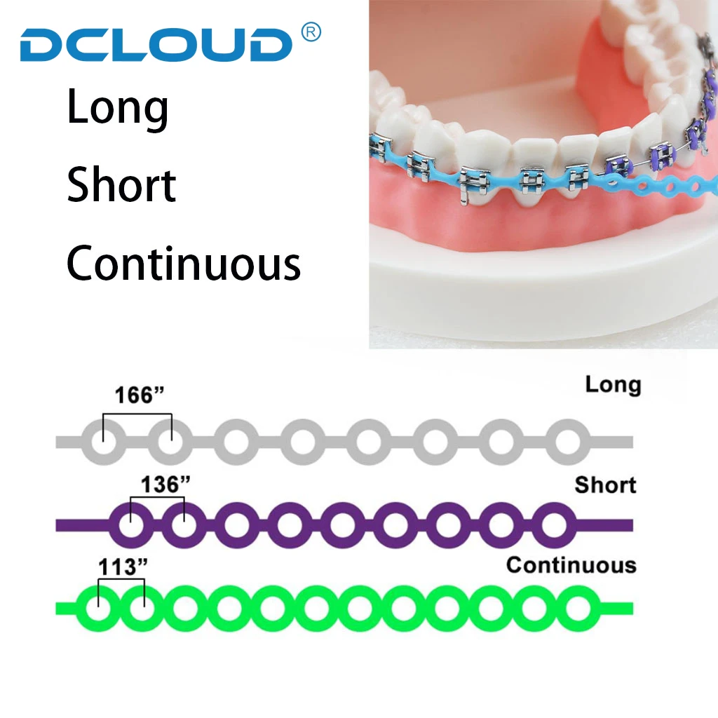 15 feet/roll Fogászati orthodontic Rablánc Alkalmazkodó m Ultra áram Megláncol Radírgumi zenekarok Fogszabályzó Zárójel stv Rövid távú Folytatólagos 4.57m/roll