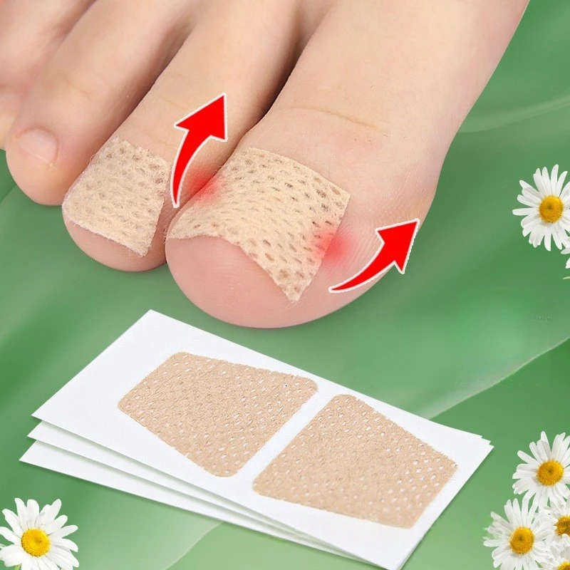 10/20 pairs Nail Care Patch Inlay Nail Groove into the Meat Toe Pad Screen Protector Long Soft Nail Gray Nail Orthopedic Sticker