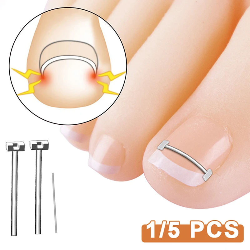 Profesjonalne narzędzie do korekcji wrastających paznokci narzędzie do pielęgnacji stóp wrastający paznokieć narzędzia do korekcji Pedicure odzyskaj osadzanie leczenia paznokci u stóp