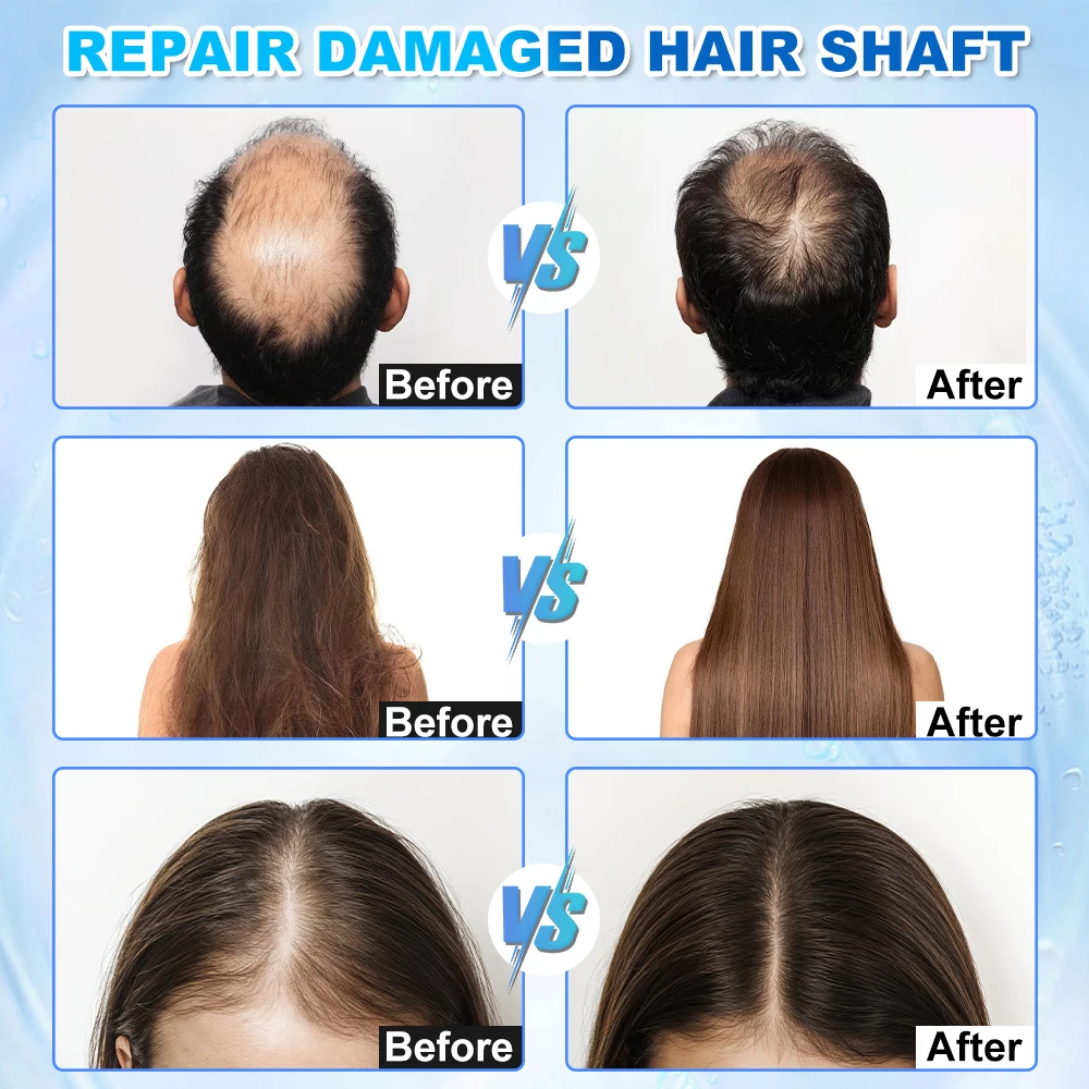 جديد 5 في 1 AI 50X 200X HD كاشف محلل الشعر رئيس مدلك الجلد فروة الرأس كاشف آلة نمو الشعر رئيس مدلك لصالون