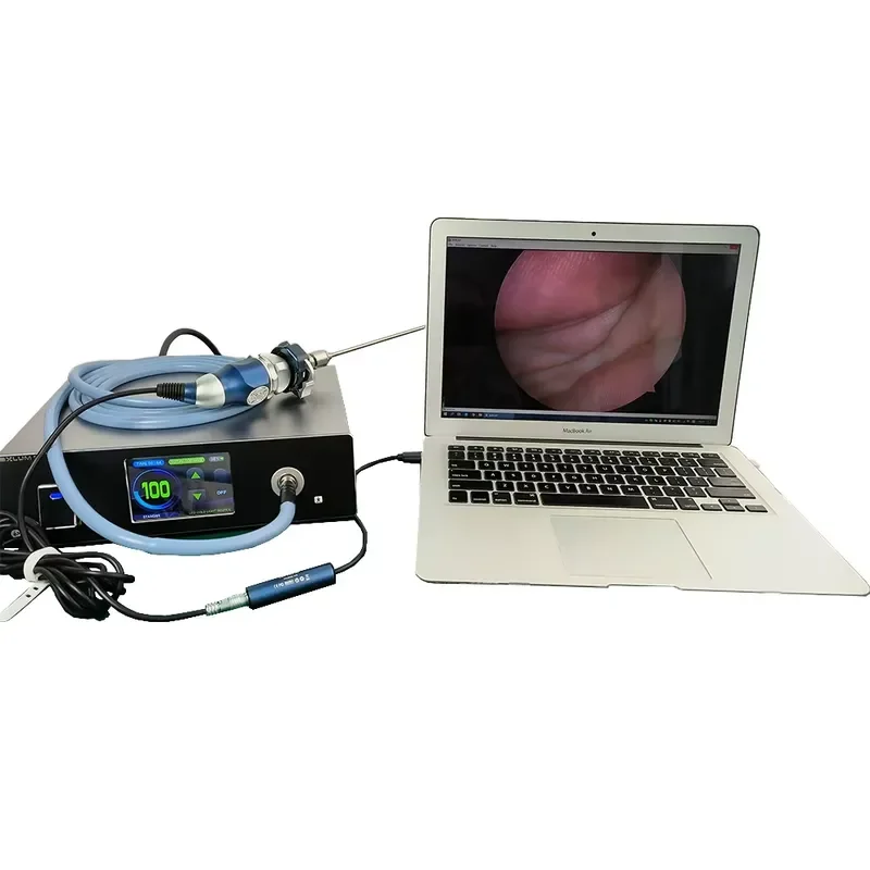 RCW Portable Endoscope 100W Led Light Source Medical Endoscopic USB HD 1080P Endoscope Camera System
