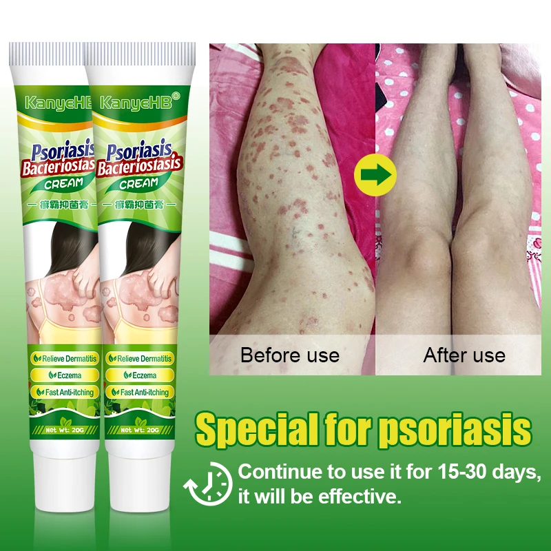 1Pcs Psoriasis Cream Remove Eczema Dermatitis Effectively Repair Skin Antibacterial Relief Genital Pruritus Herbal Ointment G024