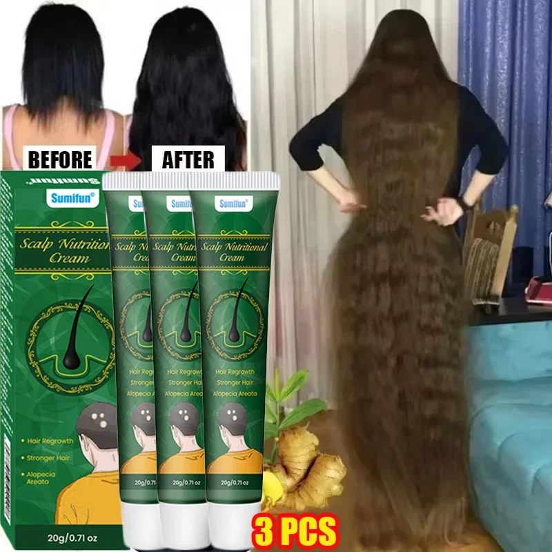 Крем для быстрого роста волос с имбирем, против выпадения волос, облысения, восстановление поврежденной кожи головы, питание, средства по уходу за корнем волос для женщин и мужчин