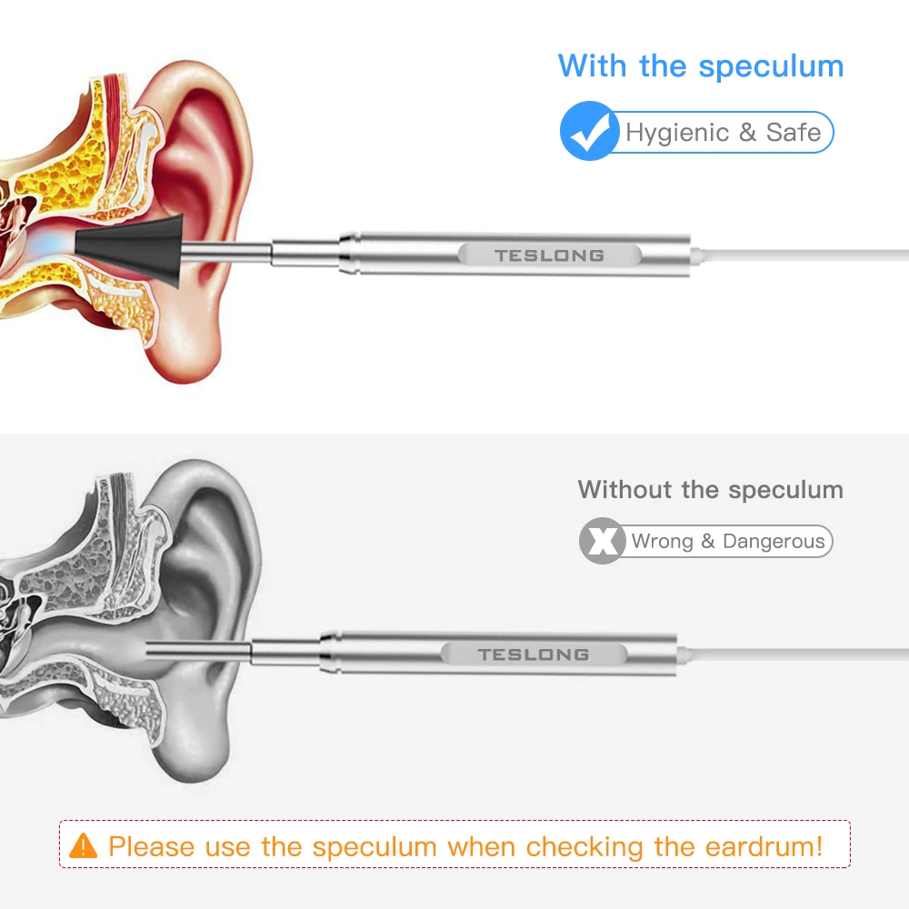 Imagem -04 - Otoscópio Médico Digital com Lente de 4.3 mm Câmera Endoscópica para Limpeza de Ouvido Remoção Visual de Cera de Ouvido Boca Nariz Inspeção Android pc