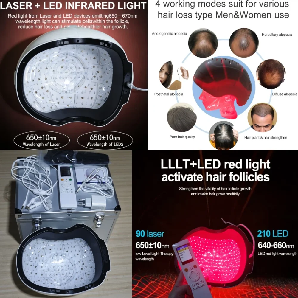 

Лазерная шапочка для роста волос с пультом ДУ, 6750 мВт, 90 диодов, 210 светодиодов, 650 нм, 660 нм для предотвращения выпадения волос и утолщения волос