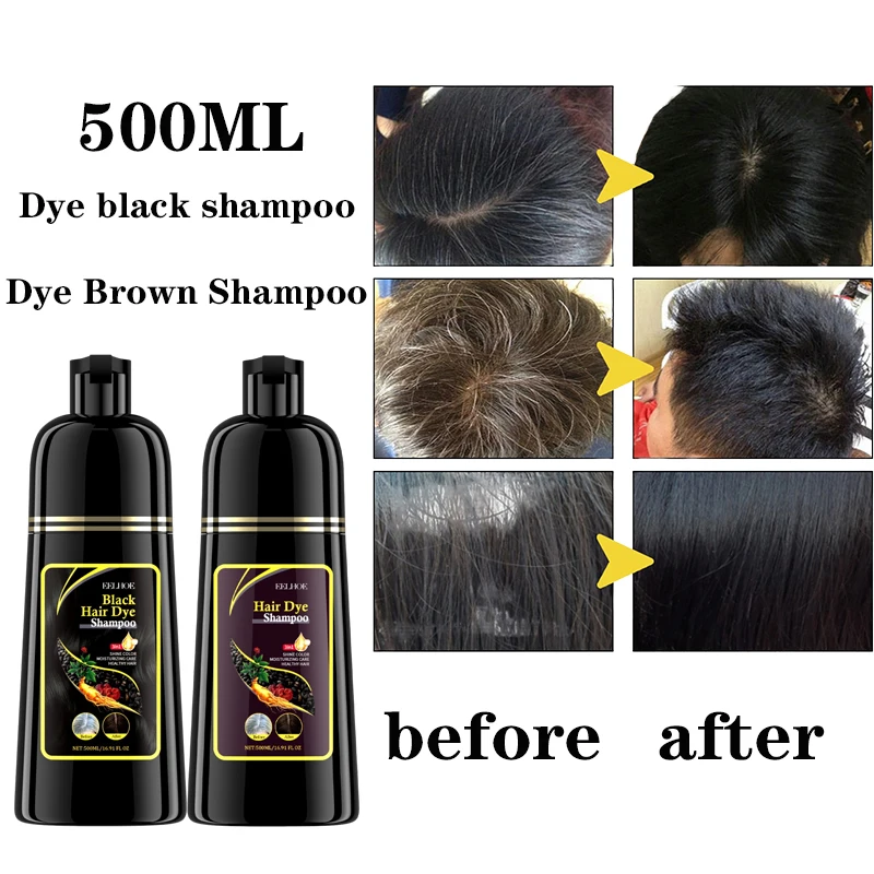 Shampooing colorant pour cheveux noirs pour hommes et femmes, colorant pour cheveux blancs, activer le follicule pileux, mélanine, traitement blanc,