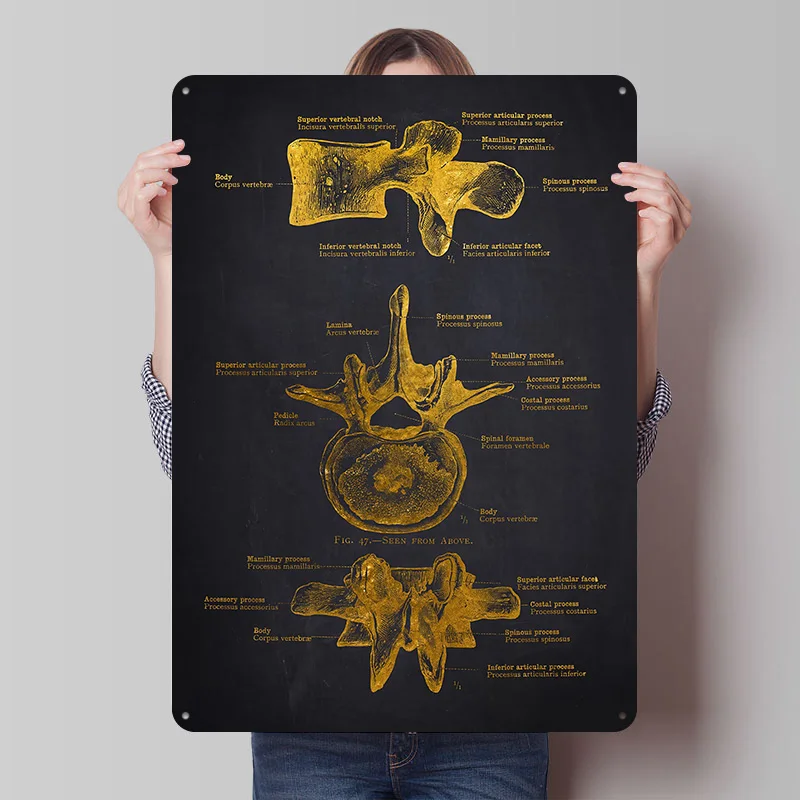 Human Vertebra Anatomy Metal Poster Custom Wall Art Retro Vintage Tinplate Signs for Man Cave Bedroom Decorations Bathroom Decor
