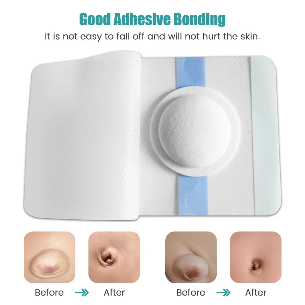 10/20pc Baby Belly Navel Patches Cotton Pads Belly Button Hernia Infant Essentials Bath Waterproof Prevent Infection Navel Patch