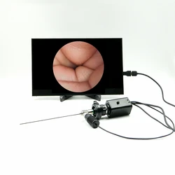 HD Handheld Portable ENT  Examination Endoscope  HDMI Interface Camera and  LED Light source and MINI LED Screen