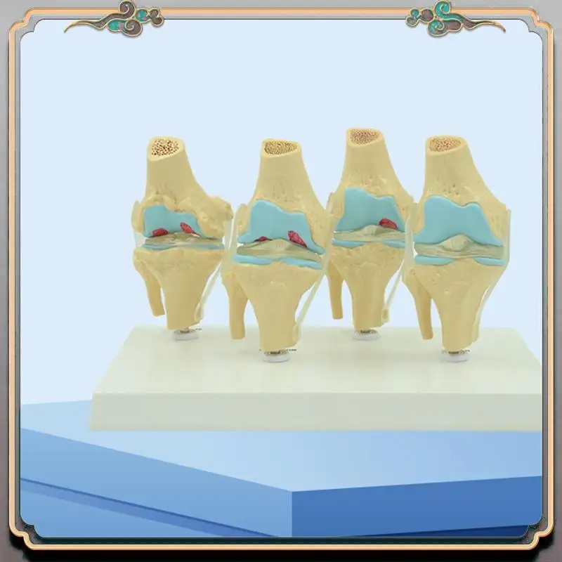 

Durable Anatomical Human Degenerative Knee Joint Model Skeleton Anatomy Teaching Resources