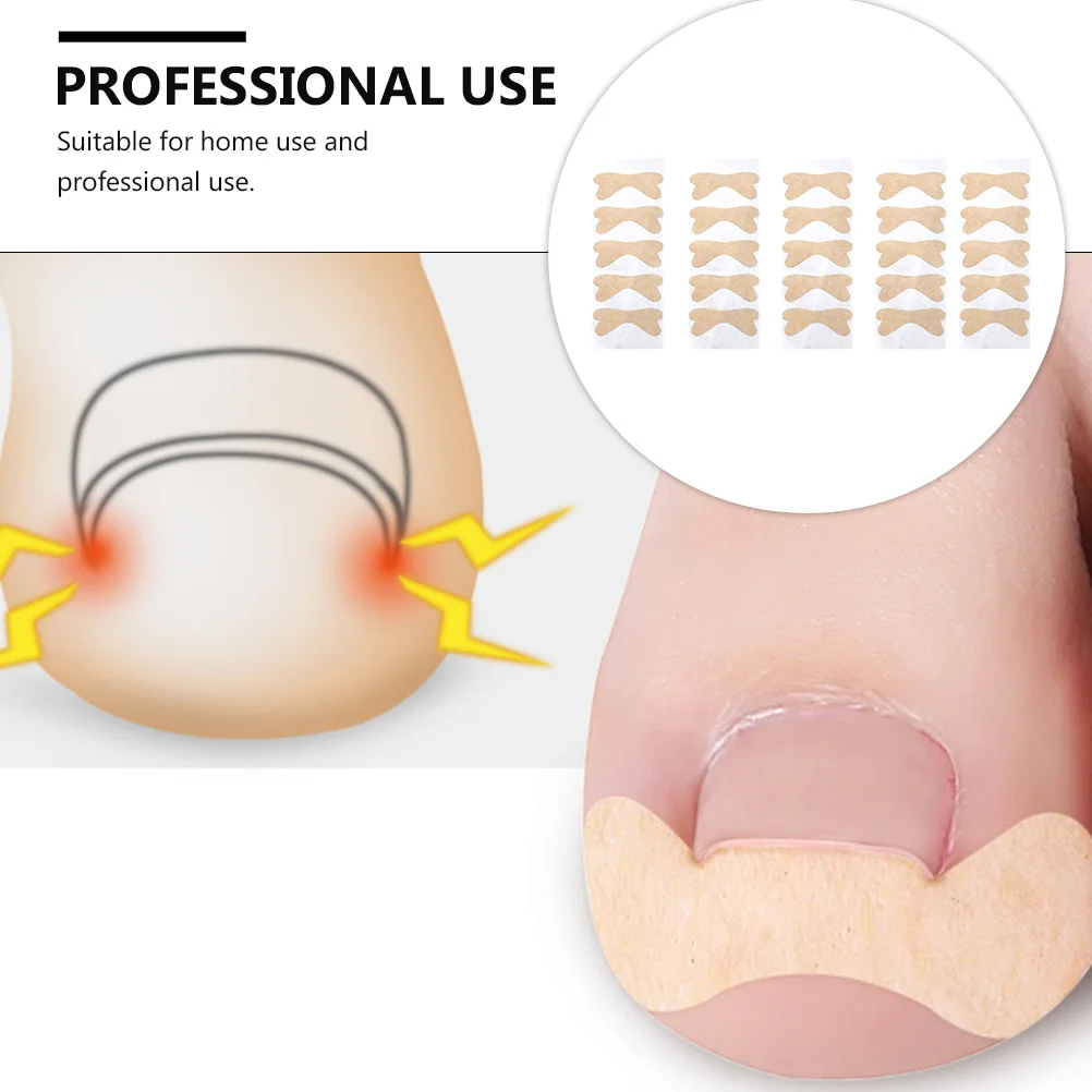 

5 Sheets Super Comfortable Ingrown Toenail Stickers Nail Care Pads Suitable For Home And Professional Use