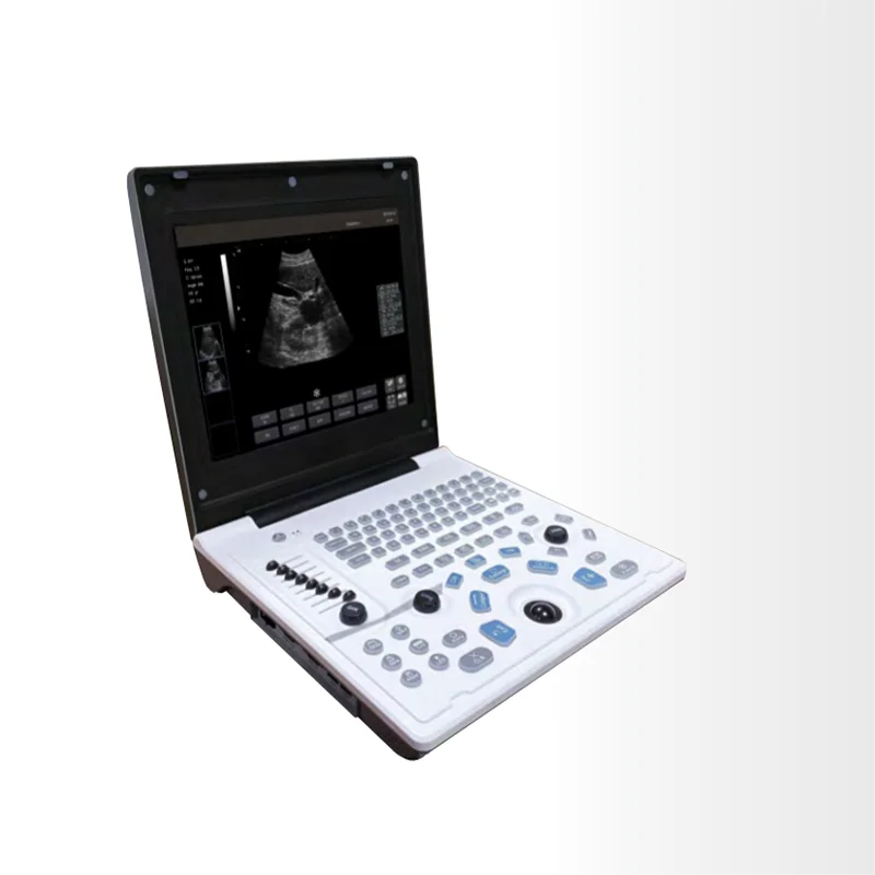 

Portable Laptop Ultrasound Scanner System Medical Equipment Easy to Operate Accurate Data