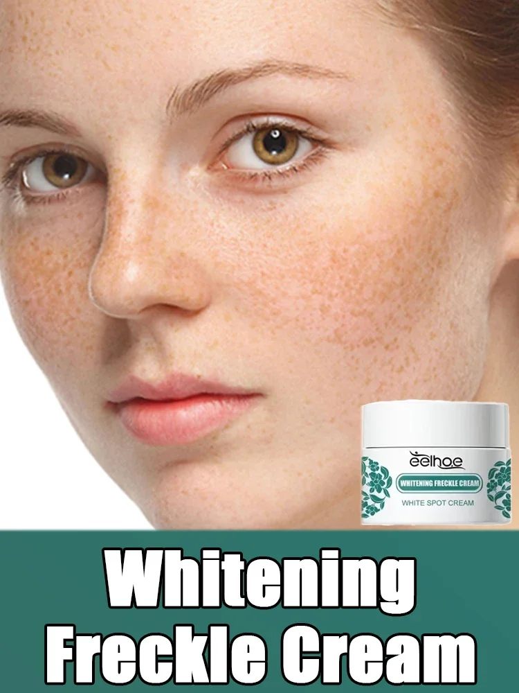 

Whitening Freckle Cream Removes Dark Spots Freckles Brightens Facial Skin Tightens Reduces Melanin Lightens Dark Skin