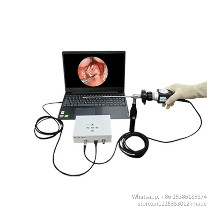 Vequyn HD USB Portable Fiber Optical Otoscope System Medical Device