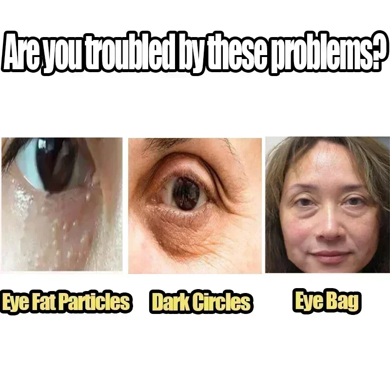 02 إزالة التجاعيد كريم عين أكياس العين الهالات السوداء مكافحة الانتفاخ شركة كريم تحت العينين تفتيح الخطوط الدقيقة ترطيب #4