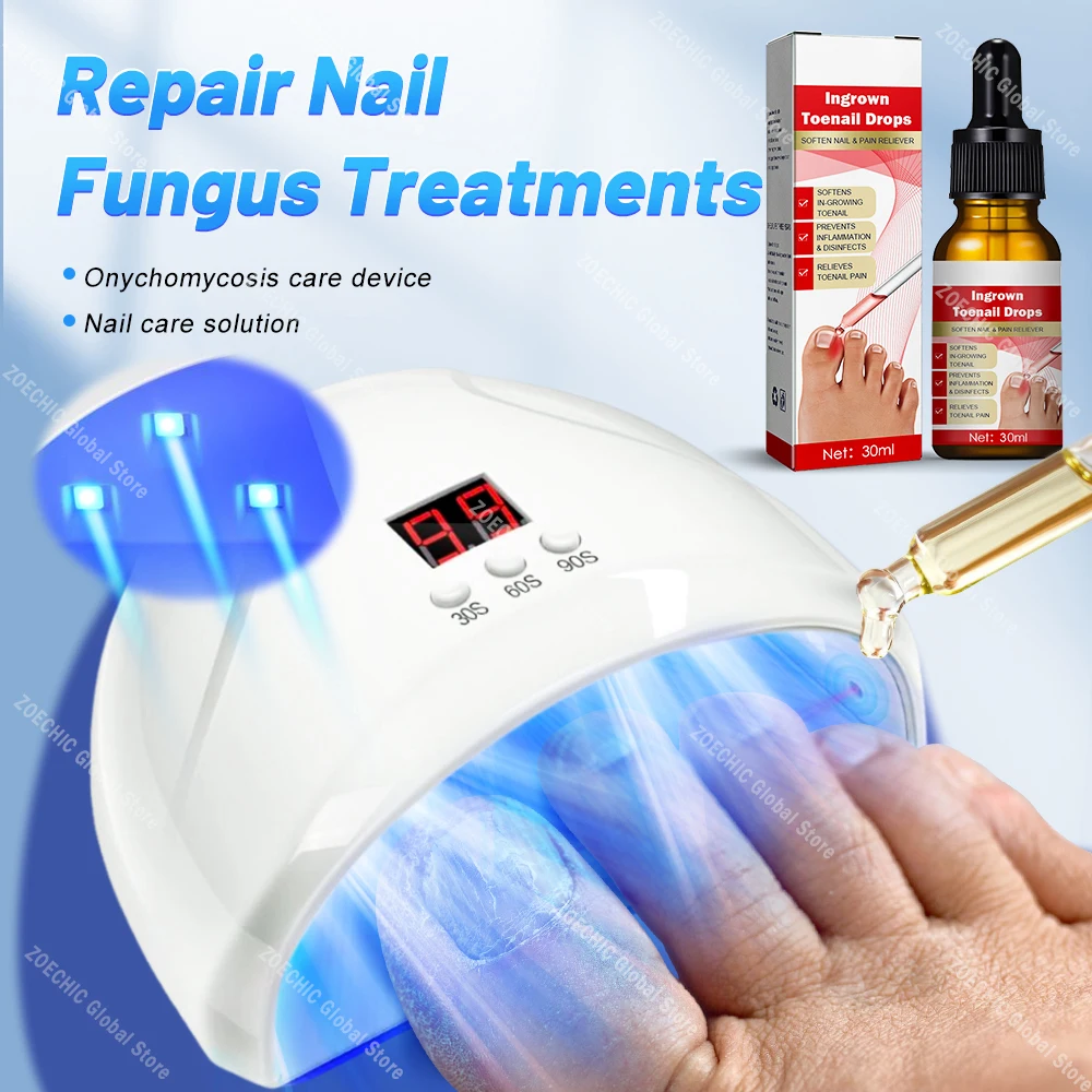 

Fungal Nail Laser Device Repair Fast Nails Fungus Onychomycosis Anti Thyroiditis Relief Pure Natural Oil Foot Care Beauty Health