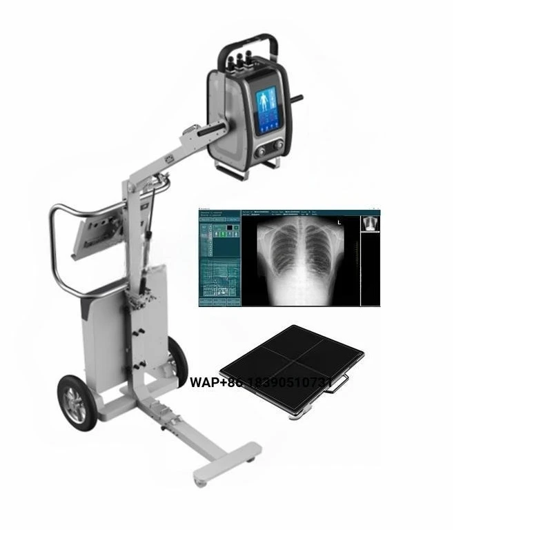 8KW 160ma high-frequency medical portable mobile radiological diagnostic X-ray machine, suitable for veterinarians and humans
